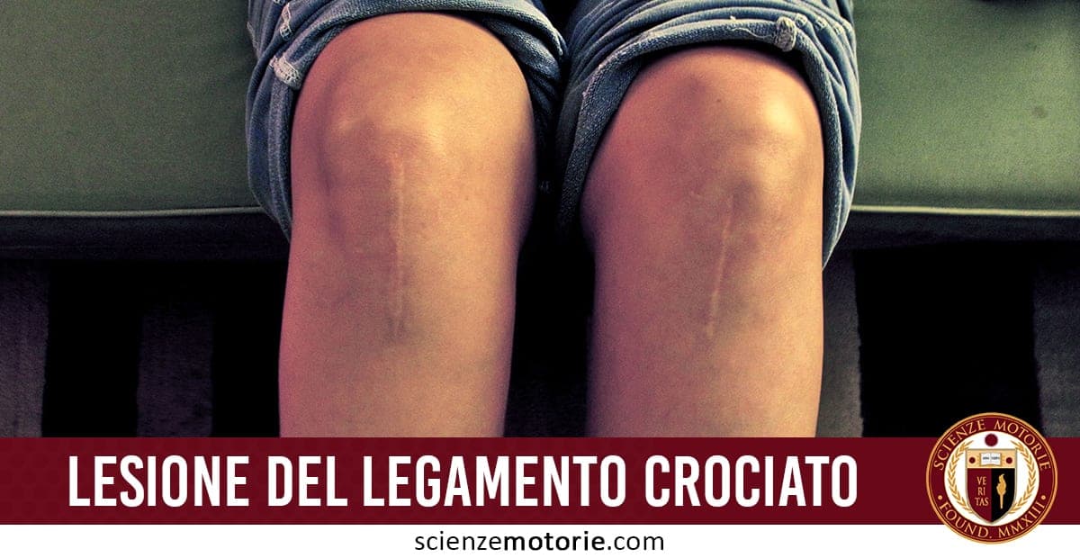 Ginocchia di persona seduta con jeans arrotolati sopra le ginocchia, cicatrici visibili, testo “Lesione del legamento crociato” e logo Scienze Motorie.