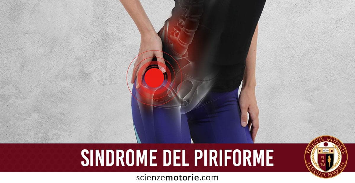 Infografica di una persona con dolore alla parte inferiore della schiena evidenziata in rosso, testo "SINDROME DEL PIRIFORME" e logo ScienzeMotorie.com in basso a destra, con dettagli anatomici del bacino in trasparenza.