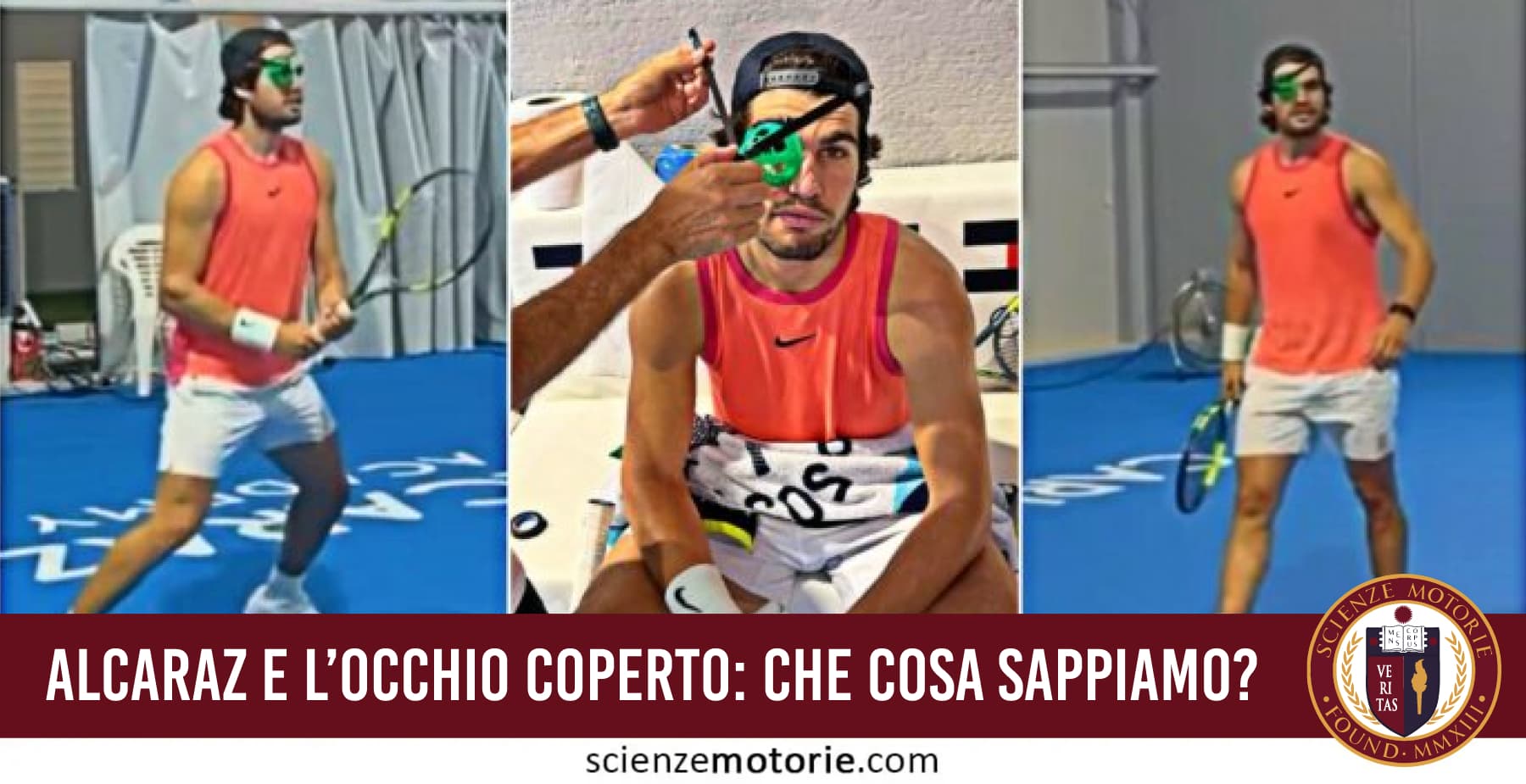 Alcaraz e l’occhio coperto: che cosa sappiamo davvero?
